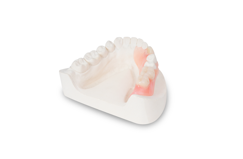Non-Monolithic Flexible Denture